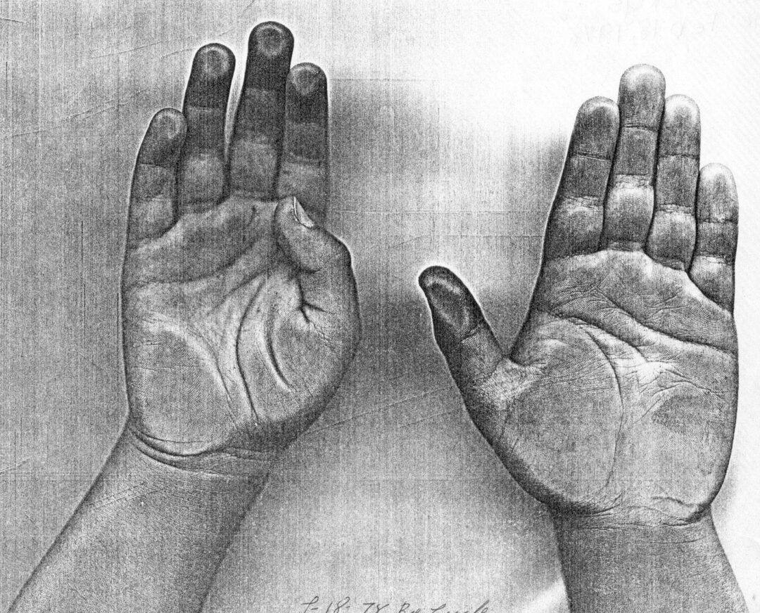 Marcelo Hands 05 18 1978(1)